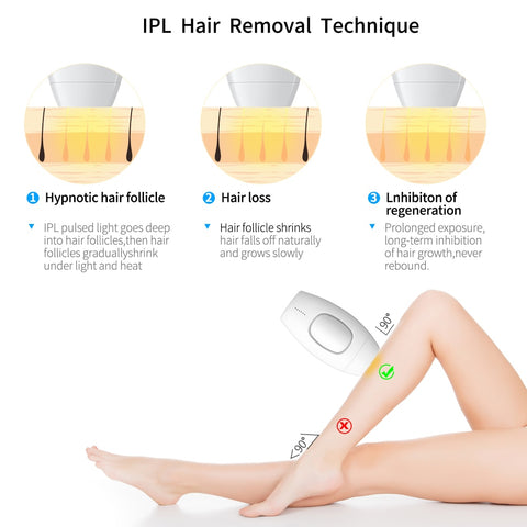 IPL Laser Hair Removal - skingeal